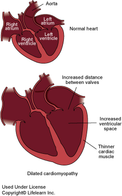 Dog Congestive Heart Failure: When To Put Them Down?